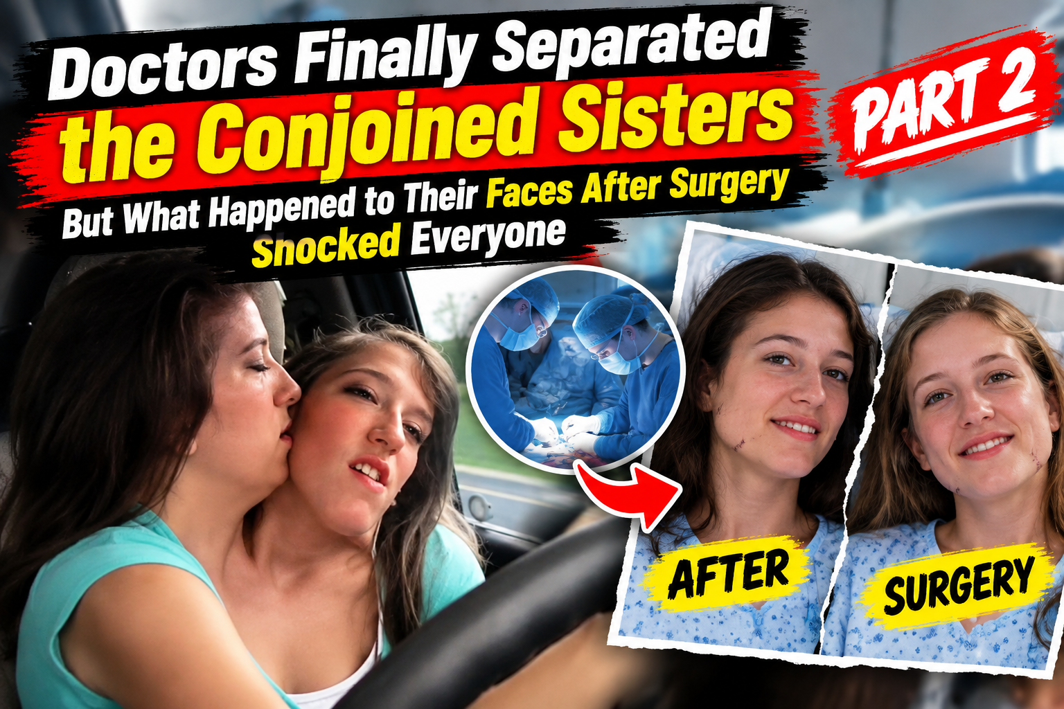 Part 2: Doctors Finally Separated the Conjoined Sisters — But What Happened to Their Faces After Surgery Shocked Everyone